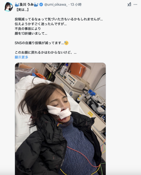 社群发文变少⋯原来及川うみ(及川海)出大事了！ 