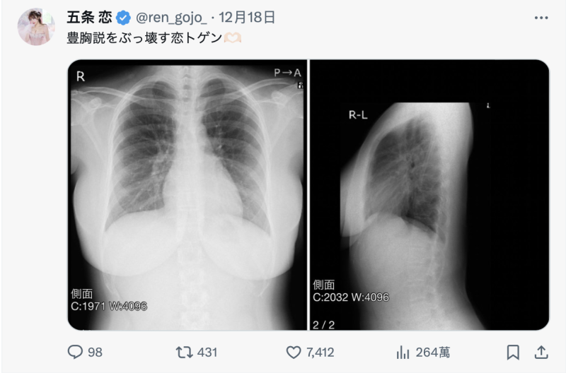 TSE最胸战士！五条恋(五条恋)不是一片限定！ 