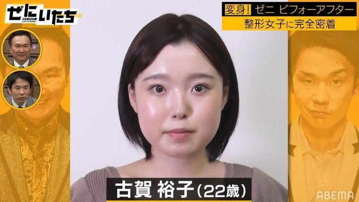 (NNPJ-557)想成为最顶的专属女优！她花了564万日币全身整形！ 