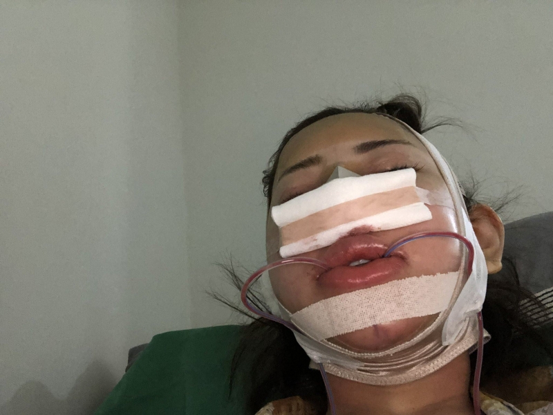 鼻子摇摇欲坠鼻尖不见了！藤井リアナ(藤井梨亚奈)整坏了！ 