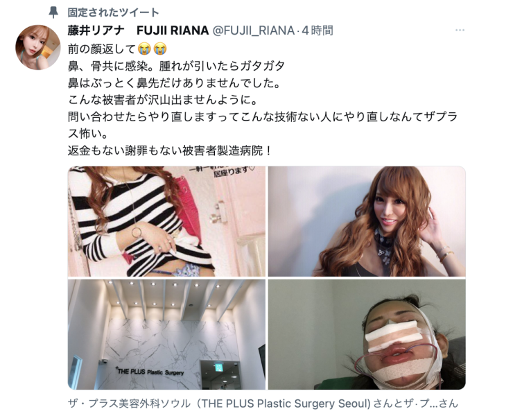 鼻子摇摇欲坠鼻尖不见了！藤井リアナ(藤井梨亚奈)整坏了！ 